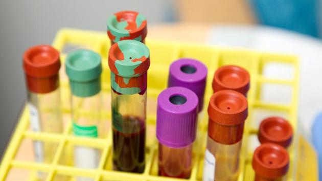 The researchers looked at pretreatment levels of 10 proteins associated with the ‘zombie’ cell in the blood of 565 Peruvian women with stage 2 and 3 cervical cancer. (Pixabay) The researchers looked at pretreatment levels of 10 proteins associated with the ‘zombie’ cell in the blood of 565 Peruvian women with stage 2 and 3 cervical cancer. (Pixabay)