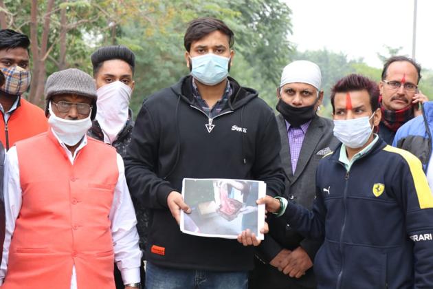 The complainant, Ravinder Singh, holds images of the bloodied towel extracted from his wife’s womb outside the Civil Hospital, in Ludhiana, on Sunday. (ht photo) The complainant, Ravinder Singh, holds images of the bloodied towel extracted from his wife’s womb outside the Civil Hospital, in Ludhiana, on Sunday. (ht photo)