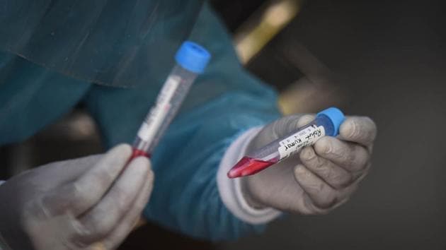 A healthcare worker preserves swab samples collected to test for Covid-19 infection, at Udyog Nagar in New Delhi on Sunday.(Sanchit Khanna/HT Photo)