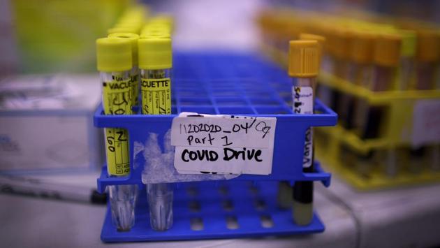 Tubes containing nasal swabs and blood collected from residents to test for Covid-19 and Covid-19 antibodies at a mobile test site in Chicago on December 12. Daily coronavirus cases and deaths have set records multiple times since Thanksgiving holidays with daily fatalities topping 3,000 for the second time last week on December 11, the same day the vaccine got approval from the Food and Drug Administration. (Scott Olson / Getty Images / AFP) Tubes containing nasal swabs and blood collected from residents to test for Covid-19 and Covid-19 antibodies at a mobile test site in Chicago on December 12. Daily coronavirus cases and deaths have set records multiple times since Thanksgiving holidays with daily fatalities topping 3,000 for the second time last week on December 11, the same day the vaccine got approval from the Food and Drug Administration. (Scott Olson / Getty Images / AFP)