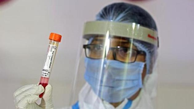 While the positivity rate of the city which was close to 30% in August, with reducing newer cases, the positivity rate, the number of positives reported for every 100 people who are tested, has dipped to below 10% as reported earlier by HT on Monday. (HT FILE PHOTO) While the positivity rate of the city which was close to 30% in August, with reducing newer cases, the positivity rate, the number of positives reported for every 100 people who are tested, has dipped to below 10% as reported earlier by HT on Monday. (HT FILE PHOTO)