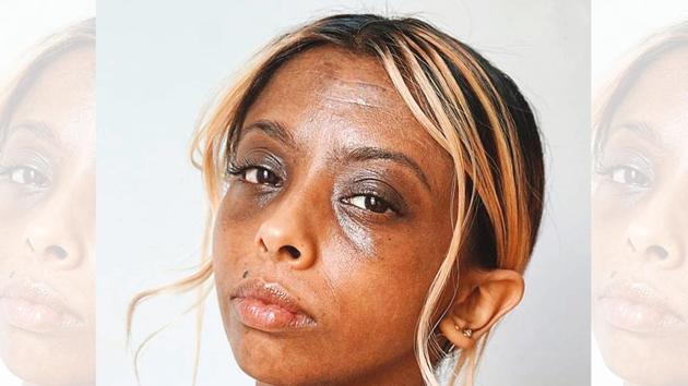 London-based Karishma is using her Instagram account to fight conventional ideas of beauty London-based Karishma is using her Instagram account to fight conventional ideas of beauty