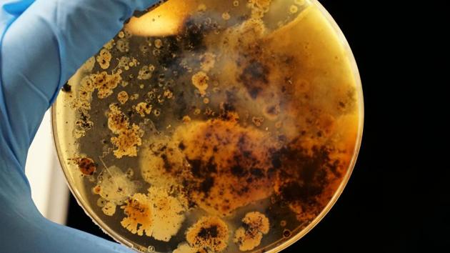 The researchers have also designed and validated a PCR test that can detect these mutations.+(Unsplash) The researchers have also designed and validated a PCR test that can detect these mutations.+(Unsplash)
