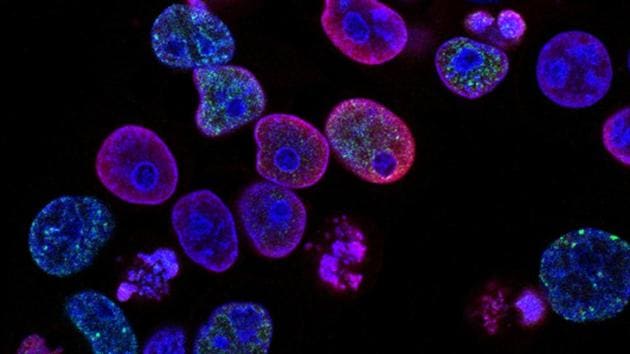 They said that testing cancers for the presence of this protein may help clinicians identify patients who may be resistant to or relapse when treated with the therapy. (Unsplash) They said that testing cancers for the presence of this protein may help clinicians identify patients who may be resistant to or relapse when treated with the therapy. (Unsplash)