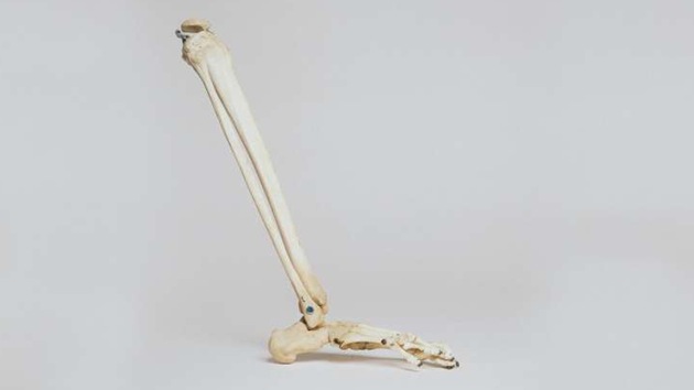 A new study suggests that a loss of enzymatic processes within the body can increase a person’s risk of bone fracture.(Yahoo) A new study suggests that a loss of enzymatic processes within the body can increase a person’s risk of bone fracture.(Yahoo)