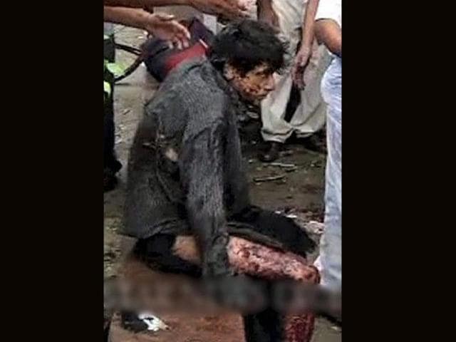 One of the injured sitting at a boundary wall after a blast outside the Delhi high court in New Delhi.