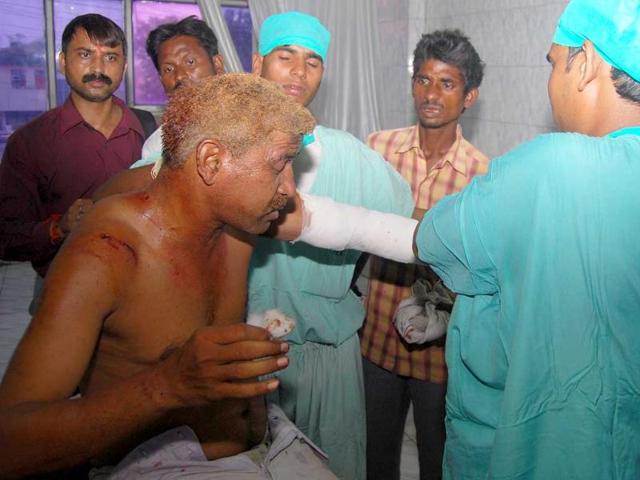 An injured being treated at the Jai hospital in Agra.