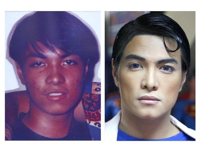 A combination photo shows Herbert Chavez before and after his cosmetic transformation to look more like the comic book character Superman in Calamba Laguna, south of Manila.