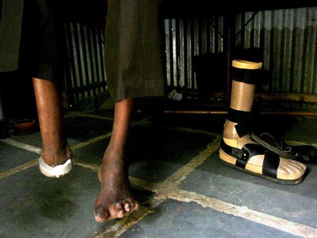 The prosthetic foot of Polipaka Gattaiah, which is said to be the longest prosthetic foot ever made, is seen in his Hyderabad room. Reuters Photo