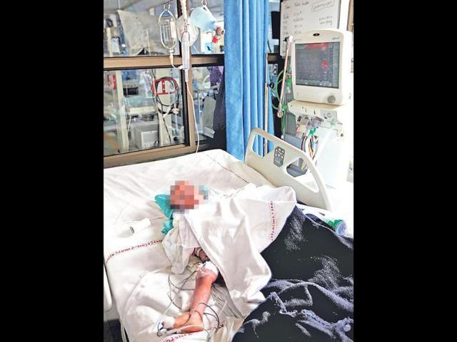 Baby-Falak-who-battled-for-life-for-almost-2-months-has-died-File-Photo-Ajay-Aggarwal-HT-photo