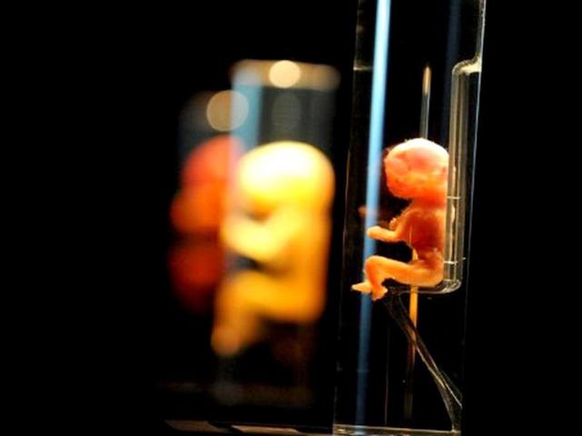 A 19-week-old fetal bone development is displayed in during an exhibition of the 'Bodies2'. AFP/Attila Kisbenedek