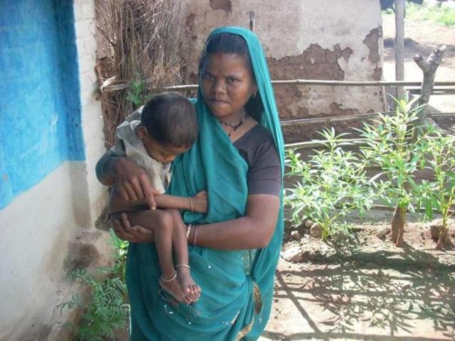 A severely malnourished child with her mother at Adnadi village. Her daily duties of tending to a newborn and working in the fields don't allow her to take her child to a public hospital.
