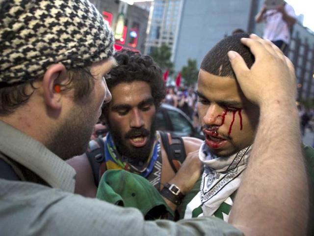 A bleeding anti-Nato protestor is comforted after a scuffle with police during a march, in Chicago. On Sunday, the start of the two-day NATO summit, thousands of protesters are expected to march to the McCormick Place convention center, where Nato delegates will be meeting. AP Photo/John Minchillo