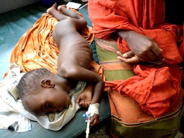 A Somali malnourished boy lies next to his mother as he receives treatment at the Banadir hospital in Mogadishu. Surging population growth is driving the planet towards food crunch, according to experts. AFP/Simon Maina