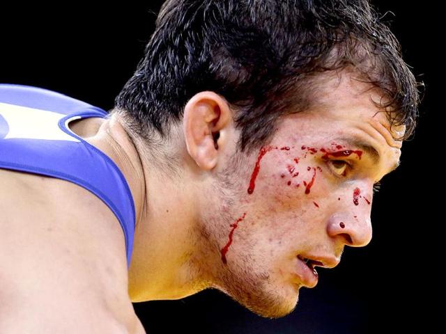 Alan Khugaev of Russia gets a cut above his eye while competing against Vladimer Gegeshidze of Georgia during the 84-kg Greco-Roman wrestling competition at the 2012 Summer Olympics in London. (AP Photo/Paul Sancya)
