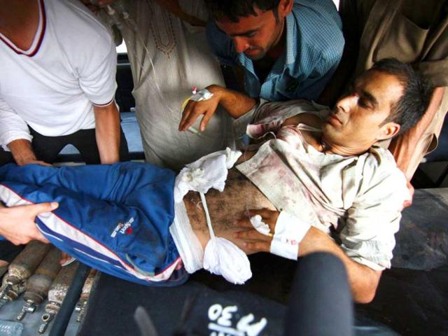 A injured Kashmiri man injured after being shot by the Border Security Force soldiers, being carried to a government medical College Hospital in Jammu. (AFP Photo)