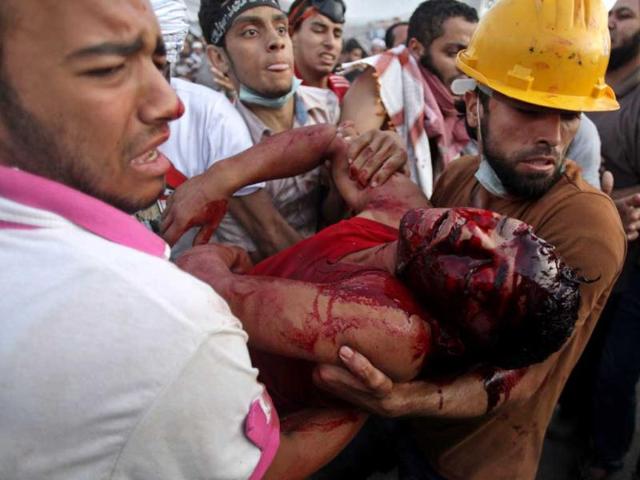 Supporters of Egypt's ousted President Mohammed Morsi carry an injured man to a field hospital following clashes with security forces at Nasr City, where pro-Morsi protesters have held a weeks-long sit-in, in Cairo, Egypt, Saturday, July 27, 2013. (AP Photo)