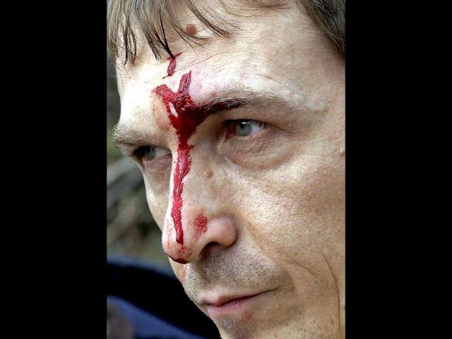 An injured Pussy Riot member after being attacked by Cossack militia at Sochi games (AP photo)