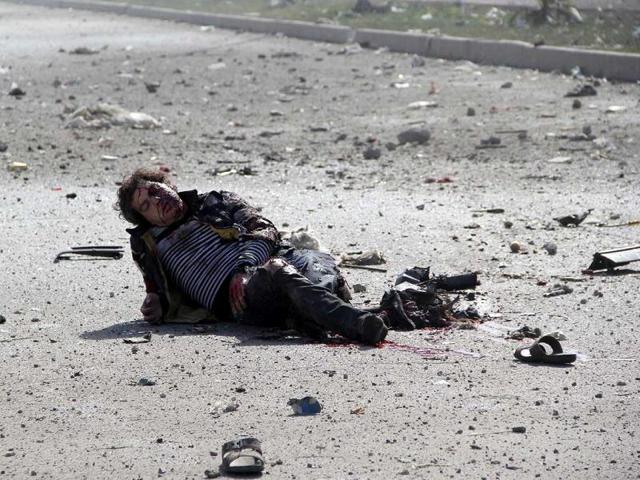 An injured man is seen on the ground following a reported air strike by government forces on April 2, 2014, in the Sakhur neighborhood of the northern Syrian city of Aleppo. (AFP Photo)
