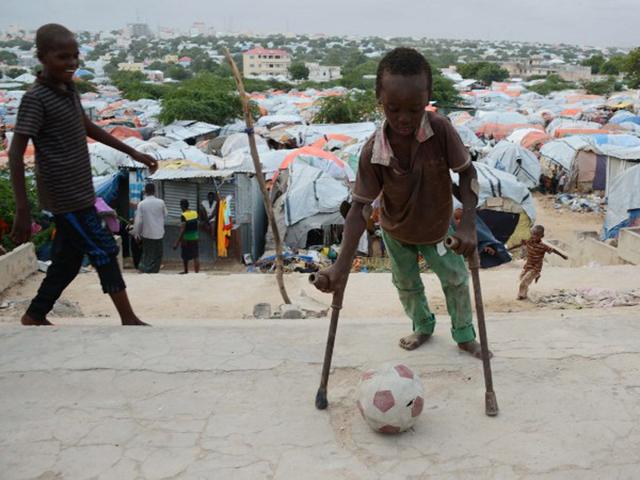 Somalia, Mogadishu: A displaced Somali boy in crutches plays with a football in front of makeshift shelters at the Sayyid camp in the Howlwadaag district of Mogadishu. (AFP PHOTO)