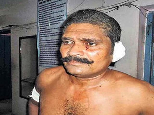 Ramanuj-Verma-with-remnants-of-his-left-ear-bandaged-HT-Photo Ramanuj-Verma-with-remnants-of-his-left-ear-bandaged-HT-Photo