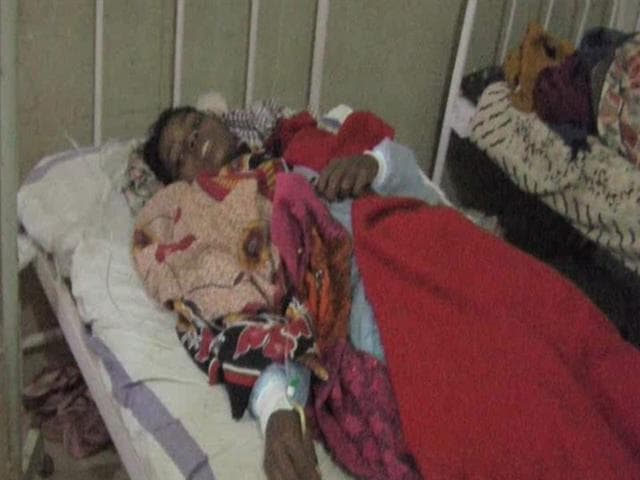 Kanchan-Devi-undergoes-treatment-at-Anuppur-district-hospital-in-Madhya-Pradesh-on-Wednesday-HT-photo Kanchan-Devi-undergoes-treatment-at-Anuppur-district-hospital-in-Madhya-Pradesh-on-Wednesday-HT-photo