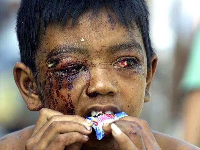 An Acehnese child who survived the 2004 tsunami eats a sweet at a military hospital in the Indonesian city of Banda Aceh in January 2005. (Reuters)