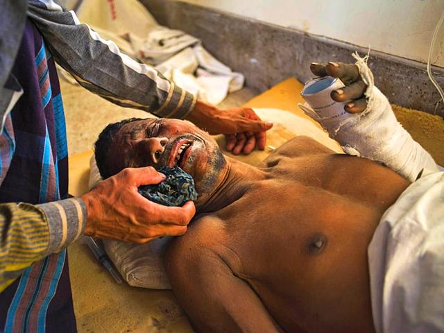 A-Bangladeshi-worker-who-was-injured-after-the-roof-of-a-cement-factory-collapsed-AFP-Photo