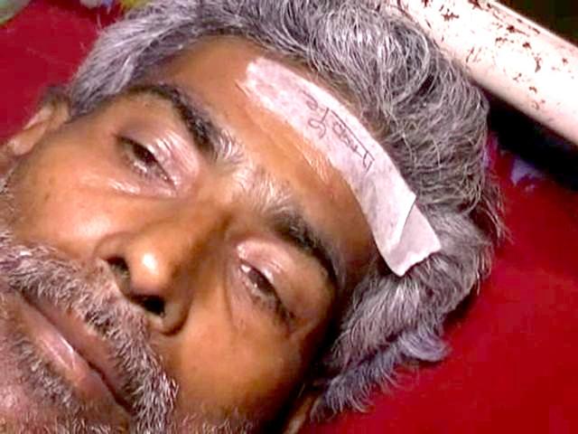 An-injured-person-at-Darbhanga-Medical-College-Hospital-with-a-sticker-pasted-on-his-forehead-HT-Photo An-injured-person-at-Darbhanga-Medical-College-Hospital-with-a-sticker-pasted-on-his-forehead-HT-Photo