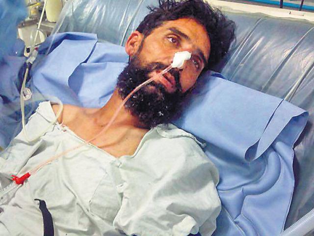 Afghanistan-national-Noor-Amir-left-at-the-hospital-HT-Photo Afghanistan-national-Noor-Amir-left-at-the-hospital-HT-Photo