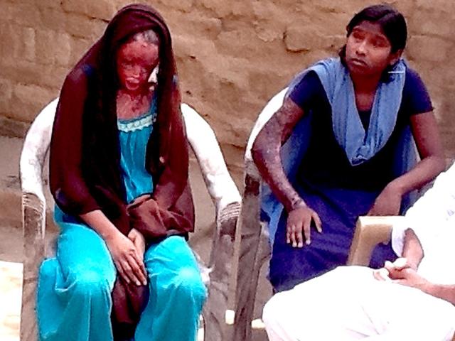 Acid-attack-victim-Chanchal-left-with-her-sister-Sonam-who-was-also-injured-in-the-attack-File-photo Acid-attack-victim-Chanchal-left-with-her-sister-Sonam-who-was-also-injured-in-the-attack-File-photo