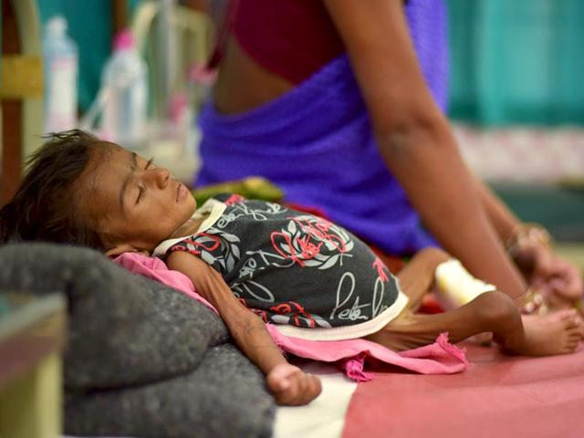 Two-month-old-Jyoti-lies-in-a-bed-in-a-malnutrition-intensive-care-unit-in-Dharbhanga-Medical-College-in-Dharbhanga--in-Bihar-Reuters Two-month-old-Jyoti-lies-in-a-bed-in-a-malnutrition-intensive-care-unit-in-Dharbhanga-Medical-College-in-Dharbhanga--in-Bihar-Reuters