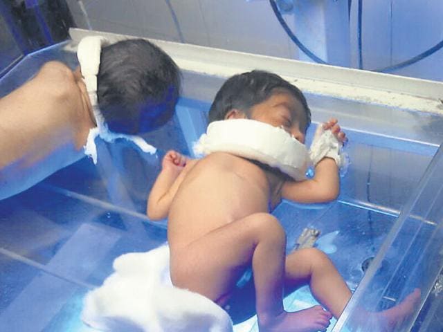 The-newborn-girl-at-the-intensive-care-unit-of-MB-Hospital-in-Udaipur-on-Monday-HT-Photo