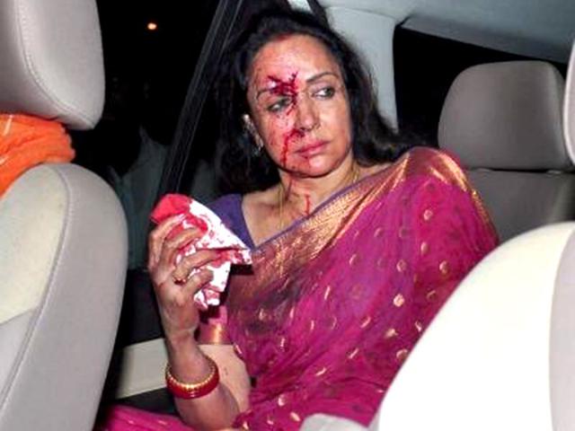Bharatiya-Janata-Party-MP-and-actor-Hema-Malini-sustained-injuries-in-a-car-accident-in-Dausa-HT-Photo Bharatiya-Janata-Party-MP-and-actor-Hema-Malini-sustained-injuries-in-a-car-accident-in-Dausa-HT-Photo