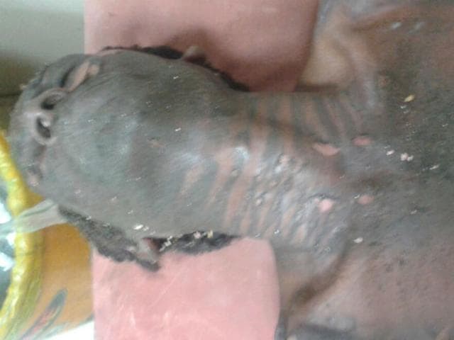 The rickshaw puller, who sustained serious injuries in an explosion at his house in Kanpur. (HT Photo)