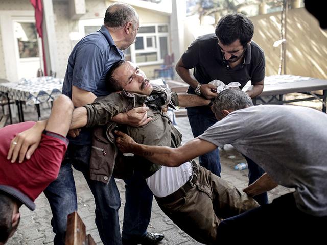 People help an injured man during clashes with Turkish police officers on Saturday at Gazi district in Istanbul. Turkey's military carried out a new wave of air and artillery strikes against Islamic State (IS) jihadists in Syria and Kurdish militants in northern Iraq, in an escalating campaign Ankara says is aimed at rooting out terror. (AFP Photo/Yasin Akgul) People help an injured man during clashes with Turkish police officers on Saturday at Gazi district in Istanbul. Turkey's military carried out a new wave of air and artillery strikes against Islamic State (IS) jihadists in Syria and Kurdish militants in northern Iraq, in an escalating campaign Ankara says is aimed at rooting out terror. (AFP Photo/Yasin Akgul)