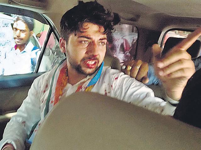 NSUI candidate Pradeep Vijayran after the violence. (Social media pic) NSUI candidate Pradeep Vijayran after the violence. (Social media pic)