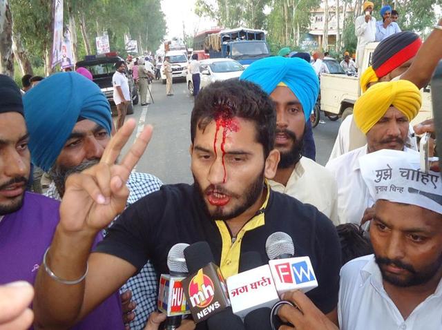 Aam Aadmi Party worker Jagroop Singh talking to the media after being attacked by protesters at Aladdin village in Tarn Taran district on Wednesday. (HT PHOTO) Aam Aadmi Party worker Jagroop Singh talking to the media after being attacked by protesters at Aladdin village in Tarn Taran district on Wednesday. (HT PHOTO)