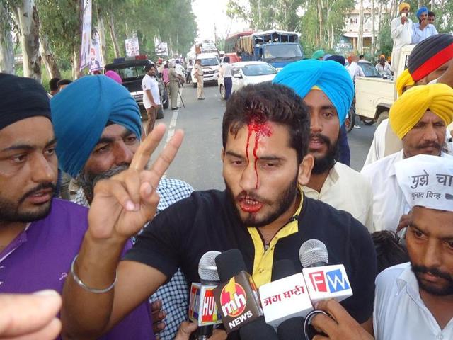 AAP worker talking to media persons after he was attacked by protesters during AAP’s Tarn Taran Rally . (HT PHOTO) AAP worker talking to media persons after he was attacked by protesters during AAP’s Tarn Taran Rally . (HT PHOTO)