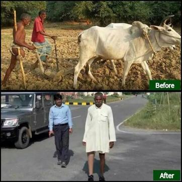 The ‘After’ photograph shows Devraj Yadav walking using the prosthetic leg. (Ashish Sagar’s Facebook profile) The ‘After’ photograph shows Devraj Yadav walking using the prosthetic leg. (Ashish Sagar’s Facebook profile)