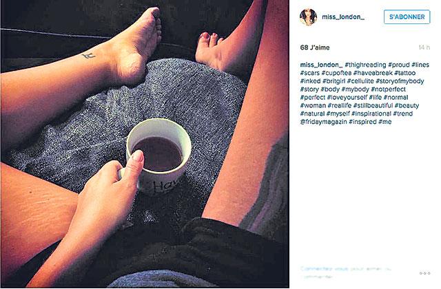 #thighreading is a body-positive statement, in which the lines on one’s thighs are flaunted and not hidden. (Instagram/Miss London) #thighreading is a body-positive statement, in which the lines on one’s thighs are flaunted and not hidden. (Instagram/Miss London)