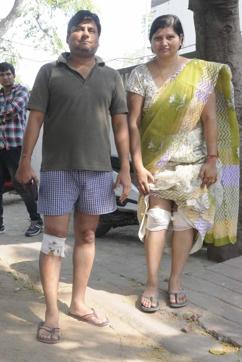 Vishal Goyal and Neetu Jain show the minor injuries they suffered while running in the commotion. (Himanshu Vyas/HT Photo)
