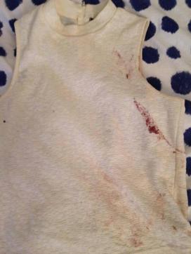 Photograph of the bloodstained shirt Isobel Bowdery wore that night. (Isobel Bowdery’s FB page) Photograph of the bloodstained shirt Isobel Bowdery wore that night. (Isobel Bowdery’s FB page)