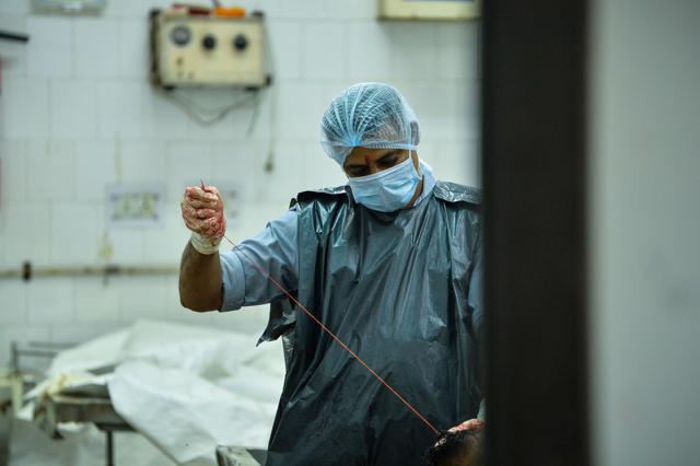 A medic stitches a body during a postmortem examination at a morgue in New Delhi. (AFP Photo) A medic stitches a body during a postmortem examination at a morgue in New Delhi. (AFP Photo)
