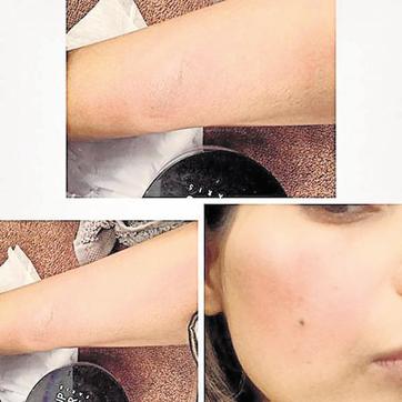 Bipasha Basu’s curling iron incident. (Instagram) Bipasha Basu’s curling iron incident. (Instagram)