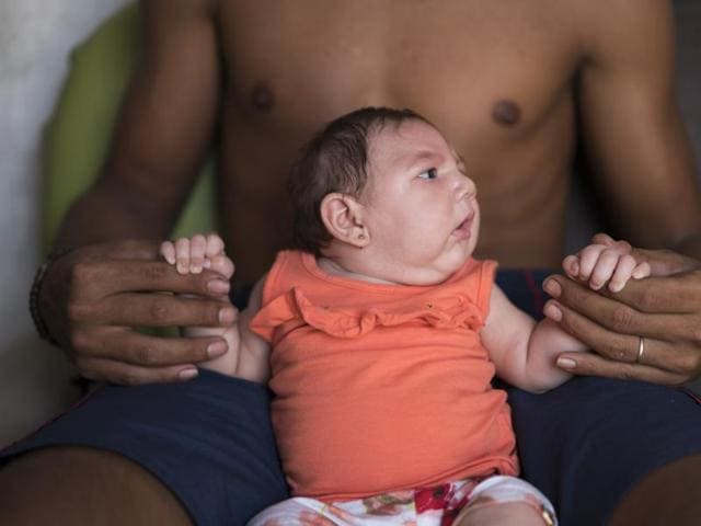 Dejailson Arruda holds his daughter Luiza at their house in Santa Cruz do Capibaribe, Pernambuco state, Brazil. Luiza was born in October with a rare condition, known as microcephaly. Luiza's mother Angelica Pereira was infected with the Zika virus after a mosquito bite.(AP Photo)