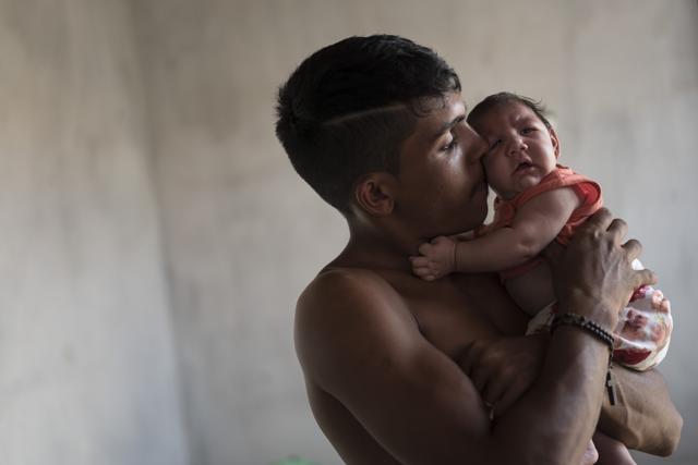 Brazil’s health officials say they’re convinced the jump is linked to a sudden outbreak of the Zika virus that infected Pereira, though international experts caution it’s far too early to be sure. (AP Photo) Brazil’s health officials say they’re convinced the jump is linked to a sudden outbreak of the Zika virus that infected Pereira, though international experts caution it’s far too early to be sure. (AP Photo)