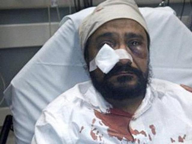 This undated photo provided by Kanwar Singh, shows his father, Inderjit Mukker, after he was beaten in a September 2015 road rage incident with a Chicago-area teenager in which the teen called the 53-year-old Sikh taxi driver “Bin Laden” and repeatedly hit him in the face.(AP)