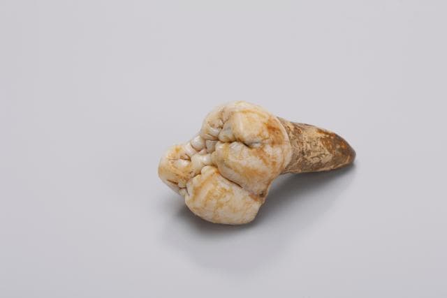 A large molar of Gigantopithecus from the collection of Gustav Heinrich Ralph von Koenigswald, in the Senckenberg Research Institute. When the teeth first surfaced in the 1930s they were sold as “dragon’s teeth”. (AFP Photo) A large molar of Gigantopithecus from the collection of Gustav Heinrich Ralph von Koenigswald, in the Senckenberg Research Institute. When the teeth first surfaced in the 1930s they were sold as “dragon’s teeth”. (AFP Photo)