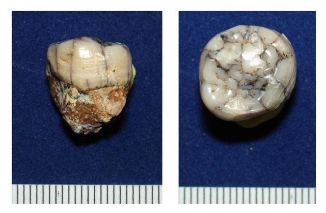 Analysing the teeth of the giant ape was how scientists determined that it followed a strictly vegetarian diet. (AFP Photo) Analysing the teeth of the giant ape was how scientists determined that it followed a strictly vegetarian diet. (AFP Photo)